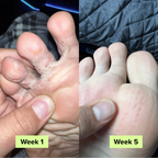 Auraluxe® AntiSchimmel Zeep Bar