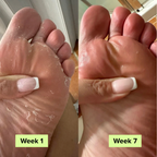 Auraluxe® AntiSchimmel Zeep Bar