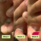 Auraluxe® AntiSchimmel Zeep Bar