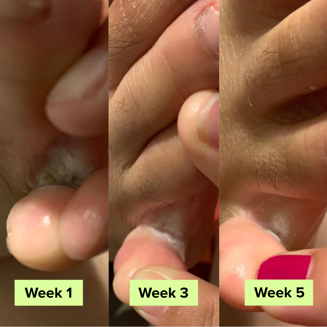 Auraluxe® AntiSchimmel Zeep Bar